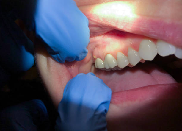 Best Emergency Treatment for Toothache in Dover Base Housing, DE