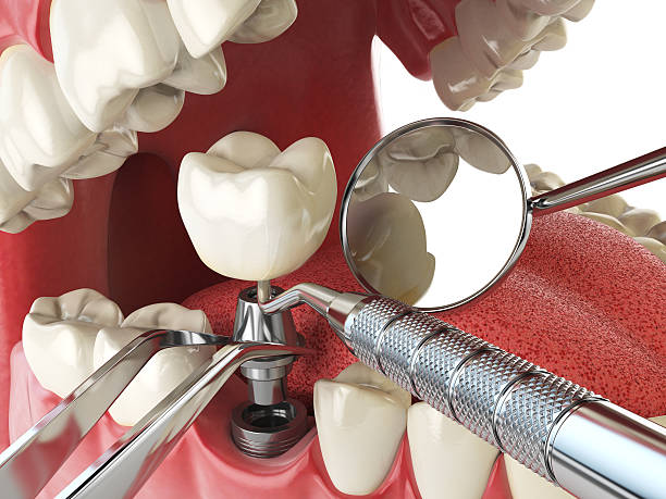 Best Walk-In Emergency Dentist in Dover Base Housing, DE