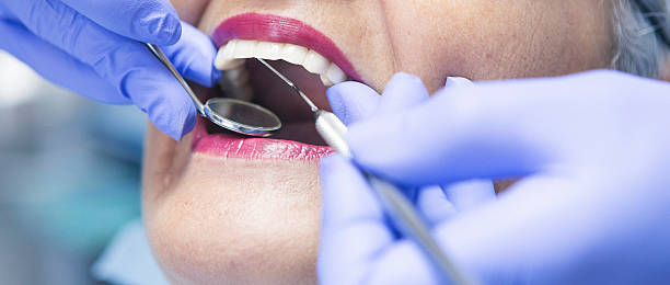 Best Emergency Wisdom Teeth Removal in Dover Base Housing, DE
